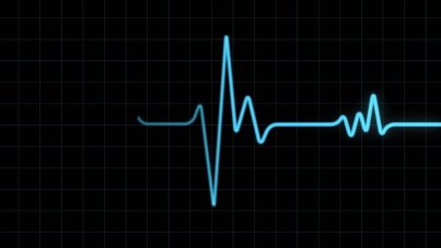 heart-monitor-blips
